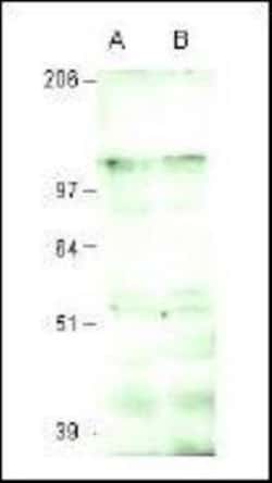 Intron-Binding Protein Of 160 KDa Antibody, Novus Biologicals 0.025 mg;