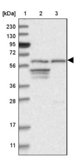 INTS11 Antibody, Novus Biologicals:Antibodies:Primary Antibodies