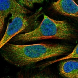 INTS11 Antibody, Novus Biologicals:Antibodies:Primary Antibodies