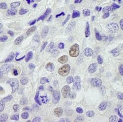 INTS11 Antibody, Novus Biologicals 0.1mg; Unlabeled:Antibodies, Polyclonal