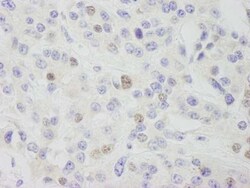 INTS11 Antibody, Novus Biologicals 0.1mg; Unlabeled:Antibodies, Polyclonal