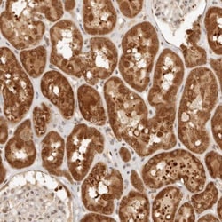 INTS11 Antibody, Novus Biologicals 0.1mL; Unlabeled:Antibodies, Polyclonal