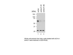 INTS11 Antibody, Novus Biologicals 0.1mg; Unlabeled:Antibodies, Polyclonal