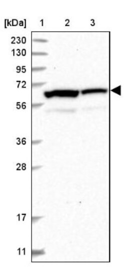 INTS11 Antibody, Novus Biologicals 0.1mL; Unlabeled:Antibodies, Polyclonal