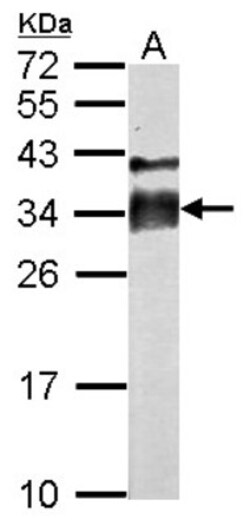 Intra Acrosomal Protein Antibody, Novus Biologicals 0.1mL; Unlabeled:Antibodies,