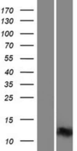 Novus Biologicals&trade;&nbsp;INTS6 Overexpression Lysate