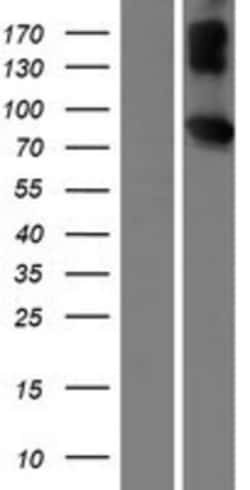 Novus Biologicals&trade;&nbsp;Invadolysin Overexpression Lysate