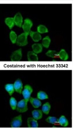 Involucrin Antibody, Novus Biologicals 0.1mL; Unlabeled:Antibodies, Polyclonal