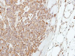 Involucrin Antibody, Novus Biologicals 0.1mL; Unlabeled:Antibodies, Polyclonal