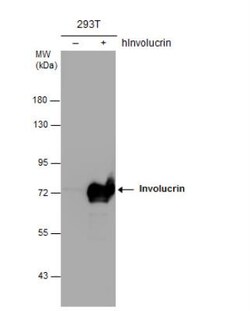 Involucrin Antibody, Novus Biologicals 0.1mL; Unlabeled:Antibodies, Polyclonal