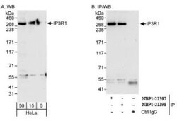 IP3R1 Antibody, Novus Biologicals 0.02mg; Unlabeled:Antibodies, Polyclonal