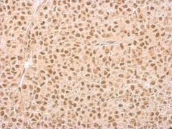 IP6K1 Antibody (10611), Novus Biologicals 0.1mL; Unlabeled:Antibodies,