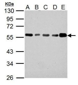 IP6K1 Antibody (10611), Novus Biologicals 0.1mL; Unlabeled:Antibodies,