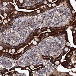 IP6K1 Antibody, Novus Biologicals 0.1mL; Unlabeled:Antistoffer