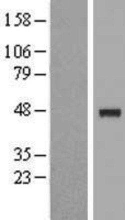 Novus Biologicals&trade;&nbsp;IP6K3 Overexpression Lysate