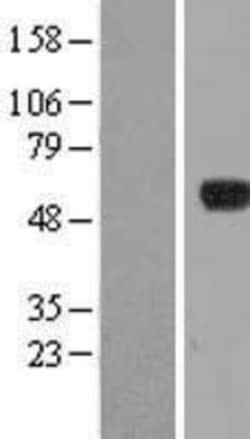 Novus Biologicals&trade;&nbsp;IPCEF1 Overexpression Lysate