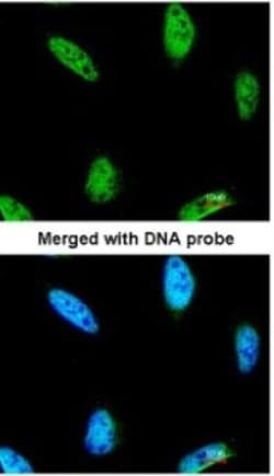 IPMK Antibody, Novus Biologicals 0.1mL; Unlabeled:Antibodies, Polyclonal