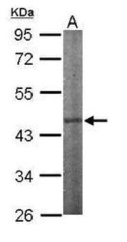 IPMK Antibody, Novus Biologicals 0.1mL; Unlabeled:Antibodies, Polyclonal