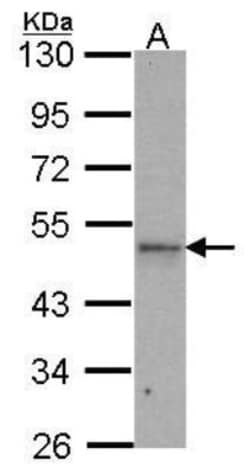 IPMK Antibody, Novus Biologicals 0.1mL; Unlabeled:Antibodies, Polyclonal