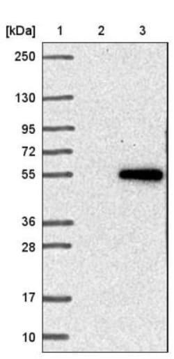 IPMK Antibody, Novus Biologicals 0.1mL; Unlabeled:Antibodies, Polyclonal