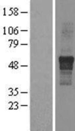 Novus Biologicals&trade;&nbsp;IPPK Overexpression Lysate