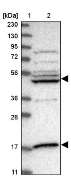 IPPK Antibody, Novus Biologicals 0.1mL; Unlabeled:Antibodies, Polyclonal