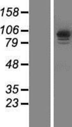 Novus Biologicals™ IQCA1 Overexpression Lysate