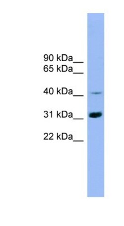 IQCD Antibody, Novus Biologicals:Antibodies:Primary Antibodies