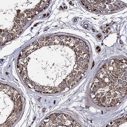 IQCH Antibody, Novus Biologicals 0.1mL; Unlabeled:Antibodies, Polyclonal