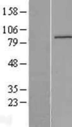 Novus Biologicals&trade;&nbsp;IQUB Overexpression Lysate