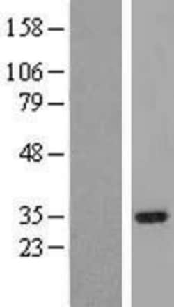 Novus Biologicals™ IRAK1BP1 Overexpression Lysate