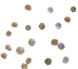 IRAK2 Antibody - BSA Free, Novus Biologicals 0.1mg; Unlabeled:Antibodies,
