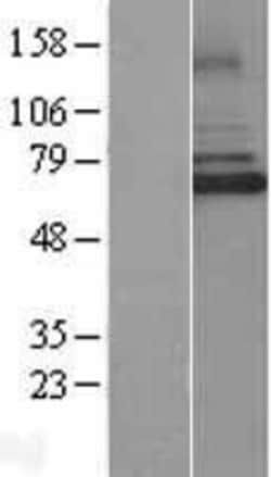 Novus Biologicals&trade;&nbsp;IRAK3 Overexpression Lysate