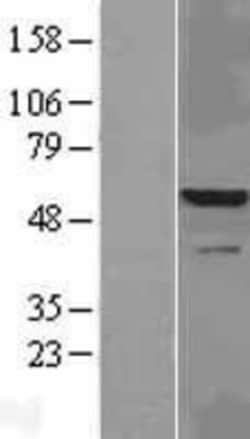 Novus Biologicals&trade;&nbsp;IRAK4 Overexpression Lysate