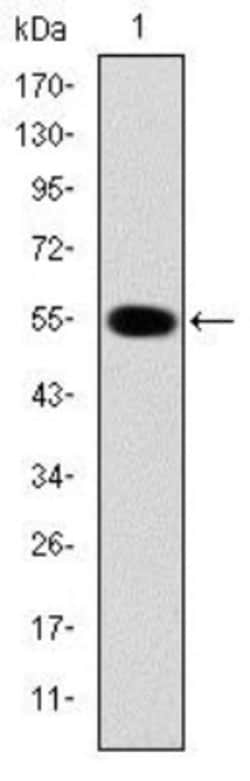 IRAK4 Antibody (2H9), Novus Biologicals 0.1mL; Unlabeled:Antibodies, Monoclonal