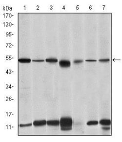 IRAK4 Antibody (2H9), Novus Biologicals 0.1mL; Unlabeled:Antibodies, Monoclonal