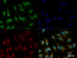 IRE1 alpha Antibody, Novus Biologicals 0.1mL; Unlabeled:Antibodies, Polyclonal