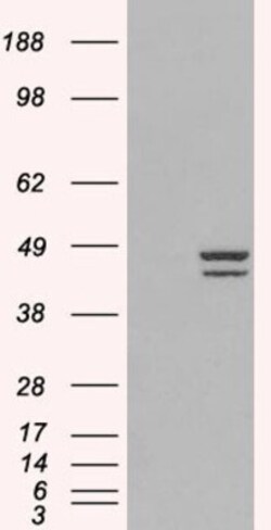 IRF2 Antibody, Novus Biologicals 0.1mg; Unlabeled:Antibodies, Polyclonal
