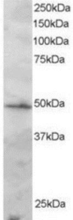 IRF2 Antibody, Novus Biologicals 0.1mg; Unlabeled:Antibodies, Polyclonal