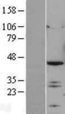 Novus Biologicals™ IRF2 Overexpression Lysate