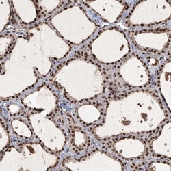 IRF2 Antibody, Novus Biologicals 25 &mu;L; Unlabeled:Antibodies, Polyclonal