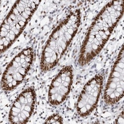 IRF2BP2 Antibody, Novus Biologicals:Antibodies:Primary Antibodies