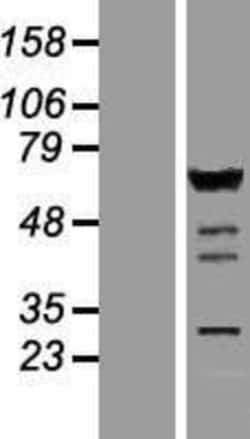 Novus Biologicals&trade;&nbsp;IRF5 Overexpression Lysate