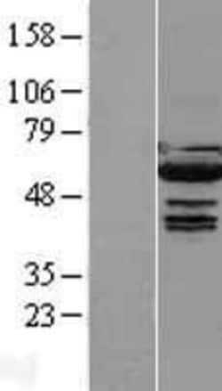Novus Biologicals&trade;&nbsp;IRF5 Overexpression Lysate