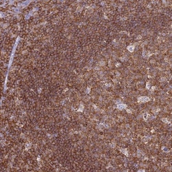 IRF5 Antibody, Novus Biologicals:Antibodies:Primary Antibodies