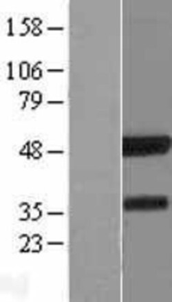 Novus Biologicals&trade;&nbsp;IRF8 Overexpression Lysate