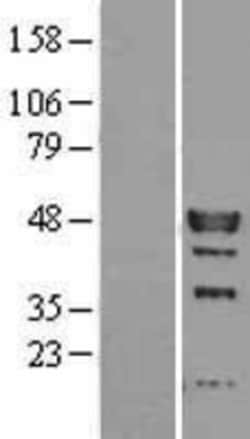 Novus Biologicals&trade;&nbsp;IRF9 Overexpression Lysate