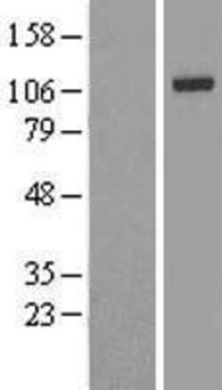 Novus Biologicals&trade;&nbsp;IRP2 Overexpression Lysate