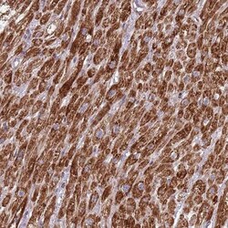 IRS4 Antibody, Novus Biologicals 25 &mu;L, Unlabeled:Antibodies, Polyclonal