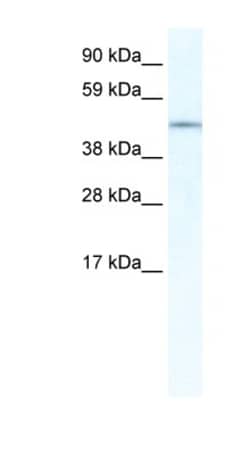 IRX3 Antibody, Novus Biologicals 100&mu;L; Unlabeled:Antibodies, Polyclonal